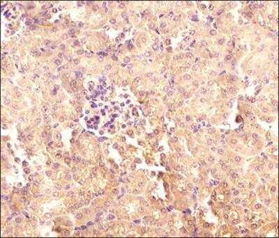 Immunohistochemistry-Paraffin: TXNIP Antibody (JY2) - Azide and BSA Free [NBP1-54578]