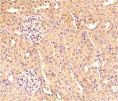 Immunohistochemistry-Paraffin: TXNIP Antibody (JY2) - Azide and BSA Free [NBP1-54578]