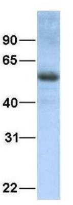 Western Blot: TXNIP Antibody [NBP1-52909]