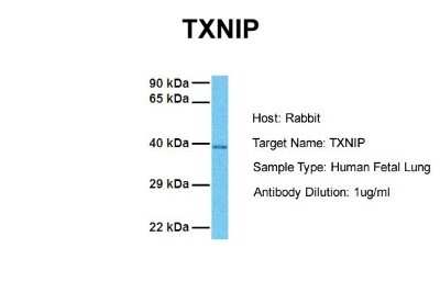 Western Blot: TXNIP Antibody [NBP1-52909]