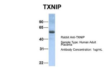Western Blot: TXNIP Antibody [NBP1-52909]