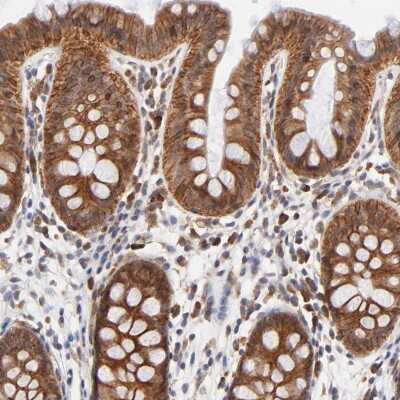 Immunohistochemistry-Paraffin: TXNL1 Antibody [NBP1-86899]