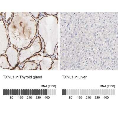 Immunohistochemistry-Paraffin: TXNL1 Antibody [NBP1-86900]