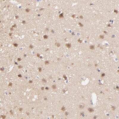 Immunohistochemistry-Paraffin: TXNL1 Antibody [NBP1-86900]