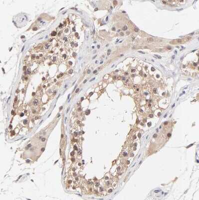 Immunohistochemistry-Paraffin: TXNL1 Antibody [NBP1-86900]