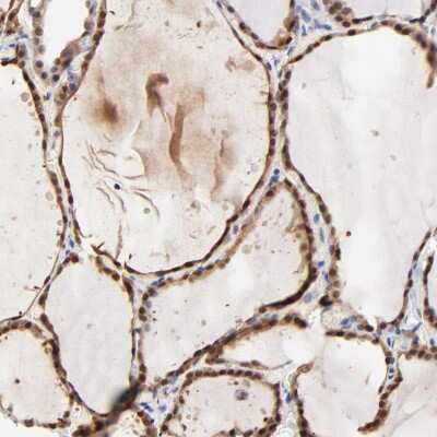 Immunohistochemistry-Paraffin: TXNL1 Antibody [NBP1-86900]