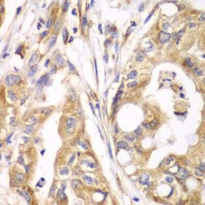 Immunohistochemistry-Paraffin: TXNRD2 Antibody - BSA Free [NBP2-94256]