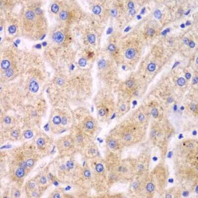 Immunohistochemistry-Paraffin: TXNRD2 Antibody - BSA Free [NBP2-94256]