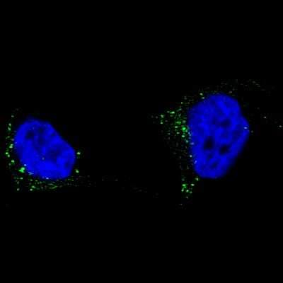 Immunocytochemistry/ Immunofluorescence: TYRP1 Antibody (CL4917) [NBP2-61147]