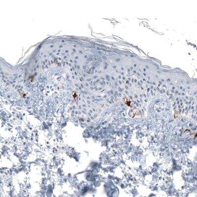 Immunohistochemistry: TYRP1 Antibody (CL4917) [NBP2-61147]