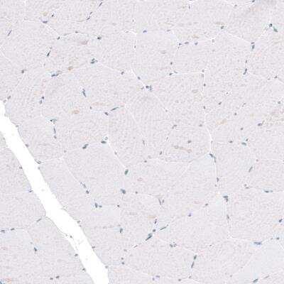 Immunohistochemistry: TYRP1 Antibody (CL4917) [NBP2-61147]