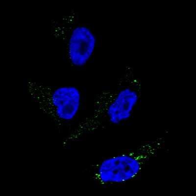 Immunocytochemistry/ Immunofluorescence: TYRP1 Antibody (CL4923) [NBP2-61642]