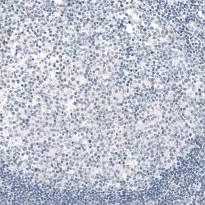 Immunohistochemistry-Paraffin: TYRP1 Antibody (CL4923) [NBP2-61642]