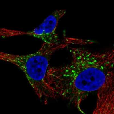 Immunocytochemistry/ Immunofluorescence: TYRP1 Antibody [NBP1-88370]