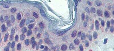 Immunohistochemistry-Paraffin: TYRP1 Antibody [NBP1-69542]