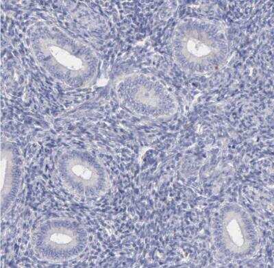 Immunohistochemistry-Paraffin: TYRP1 Antibody [NBP1-88370]