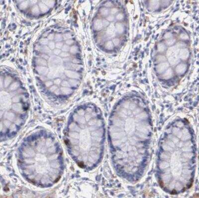 Immunohistochemistry-Paraffin: TYRP1 Antibody [NBP1-88370]