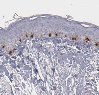 Immunohistochemistry-Paraffin: TYRP1 Antibody [NBP1-88370]