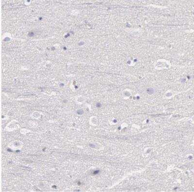 Immunohistochemistry-Paraffin: TYRP1 Antibody [NBP1-88370]