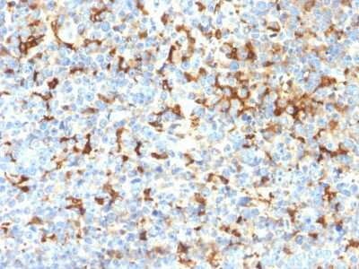 Immunohistochemistry-Paraffin: TYRP1 Antibody (TYRP1/2340R) [NBP3-07156]