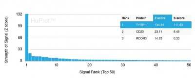 Protein Array: TYRP1 Antibody (TYRP1/3280) [NBP2-79792]