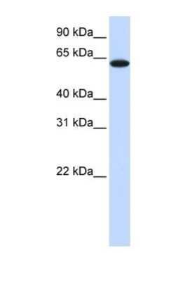 Western Blot: TYRP1 Antibody [NBP1-69542]