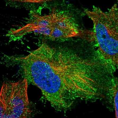 Immunocytochemistry/ Immunofluorescence: TYW3 Antibody [NBP1-88492]