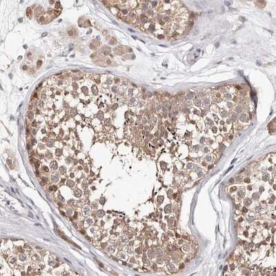 Immunohistochemistry-Paraffin: TYW3 Antibody [NBP1-88492]