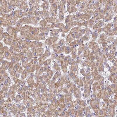 Immunohistochemistry-Paraffin: TYW5 Antibody [NBP1-94109]