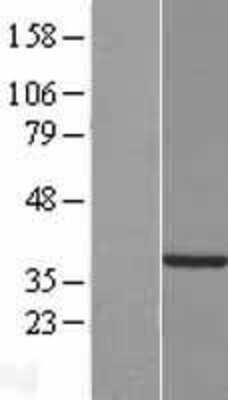 Western Blot: TYW5 Overexpression Lysate [NBP2-08544]