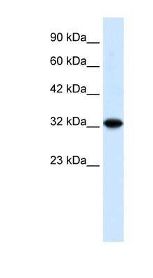 Western Blot: TZFP Antibody [NBP1-79984]