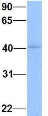 Western Blot: TZFP Antibody [NBP1-79984]