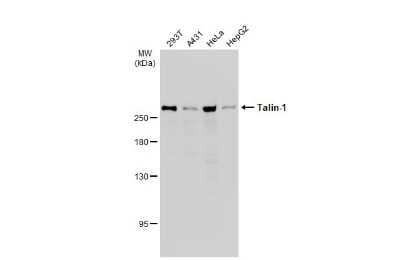 Western Blot: Talin1 Antibody [NBP3-13400]