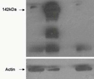 Western Blot: Tankyrase 1 Antibody [NBP1-36994]
