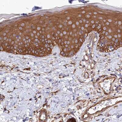 Immunohistochemistry-Paraffin: Tankyrase binding protein 1 Antibody [NBP1-89826]