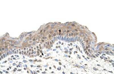 Immunohistochemistry-Paraffin: Tapasin Antibody [NBP1-59071]