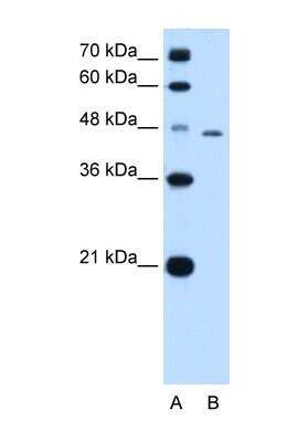 Western Blot: Tapasin Antibody [NBP1-59071]