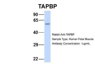 Western Blot: Tapasin Antibody [NBP1-59938]