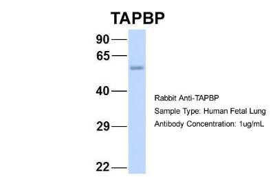 Western Blot: Tapasin Antibody [NBP1-59938]