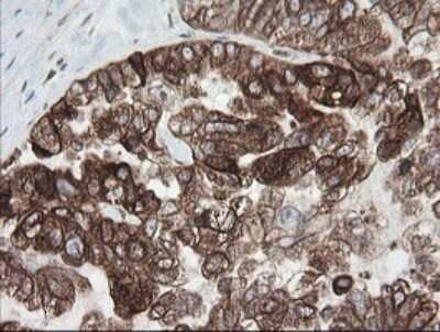 Immunohistochemistry: TAPBPR Antibody (OTI4H5) - Azide and BSA Free [NBP2-74443]