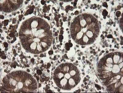 Immunohistochemistry: TAPBPR Antibody (OTI4H5) - Azide and BSA Free [NBP2-74443]