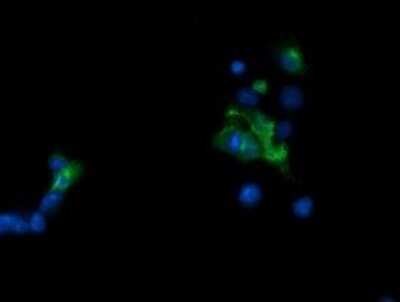 Immunofluorescence: TAPBPR Antibody (OTI4H5) [NBP2-46066]