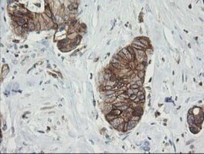 Immunohistochemistry: TAPBPR Antibody (OTI4H5) [NBP2-46066]