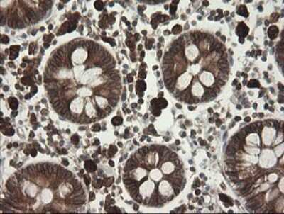 Immunohistochemistry: TAPBPR Antibody (OTI4H5) [NBP2-46066]