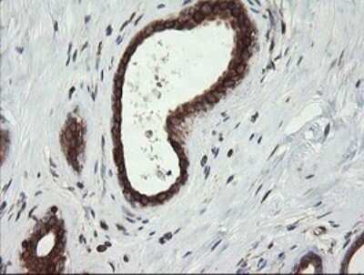 Immunohistochemistry: TAPBPR Antibody (OTI4H5) [NBP2-46066]