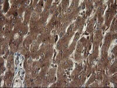 Immunohistochemistry: TAPBPR Antibody (OTI4H5) [NBP2-46066]