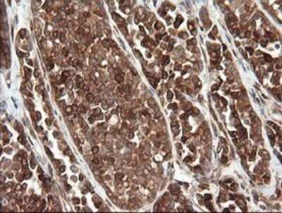 Immunohistochemistry: TAPBPR Antibody (OTI4H5) [NBP2-46066]