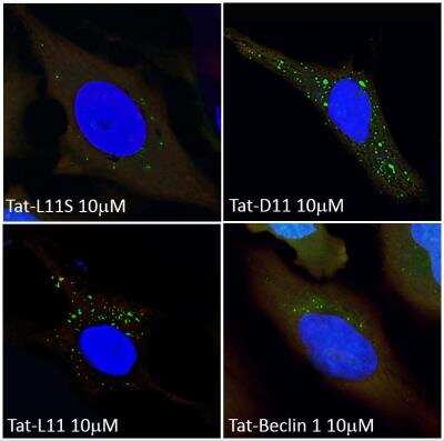 Immunocytochemistry/ Immunofluorescence: Tat-Beclin 1 L11S Peptide - Scrambled Control [NBP2-49887]