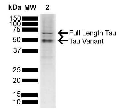 Western Blot: Tau Antibody [NBP3-18237]