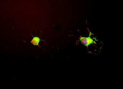 Immunocytochemistry/ Immunofluorescence: Tau Antibody (2E9) [NBP2-25162]